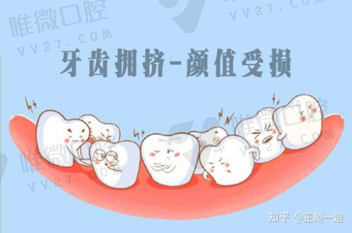 涂氧和窝沟封闭有什么区别,用流体做窝沟封闭的步骤(图1)